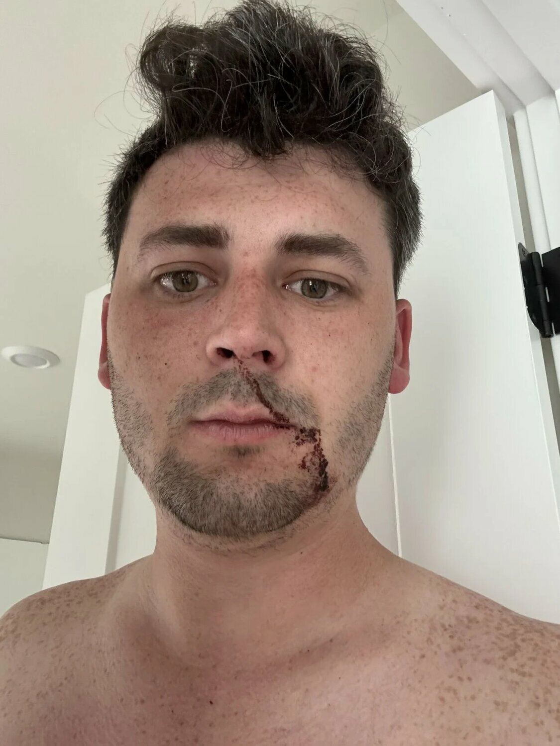 Seattle police investigating attack on journalist during Antifa protests