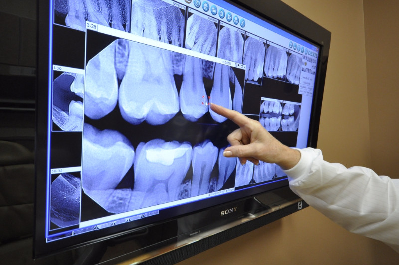 how-safe-are-dental-x-rays-herald-community-newspapers-www